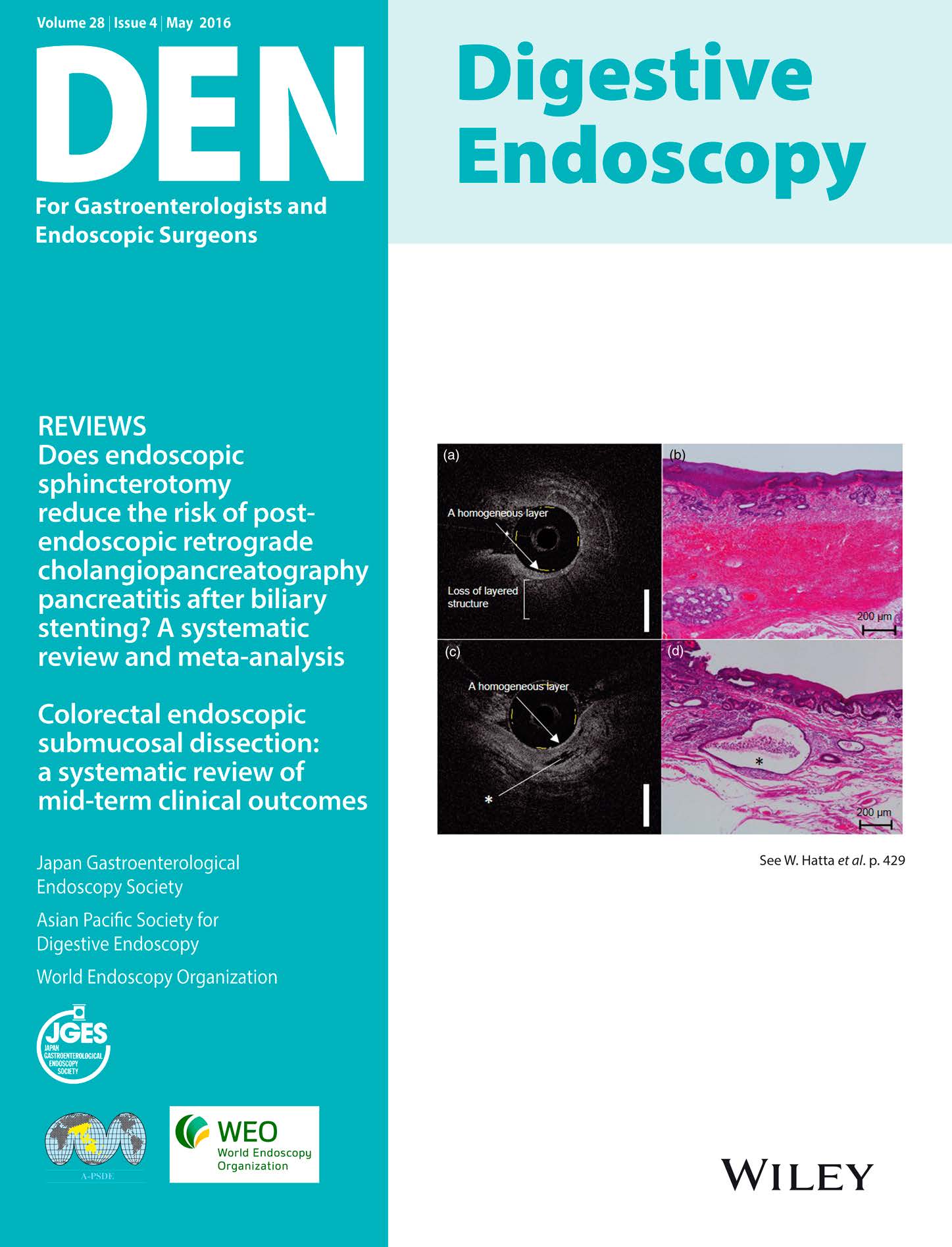 Digestive Endoscopy Vol28-4
