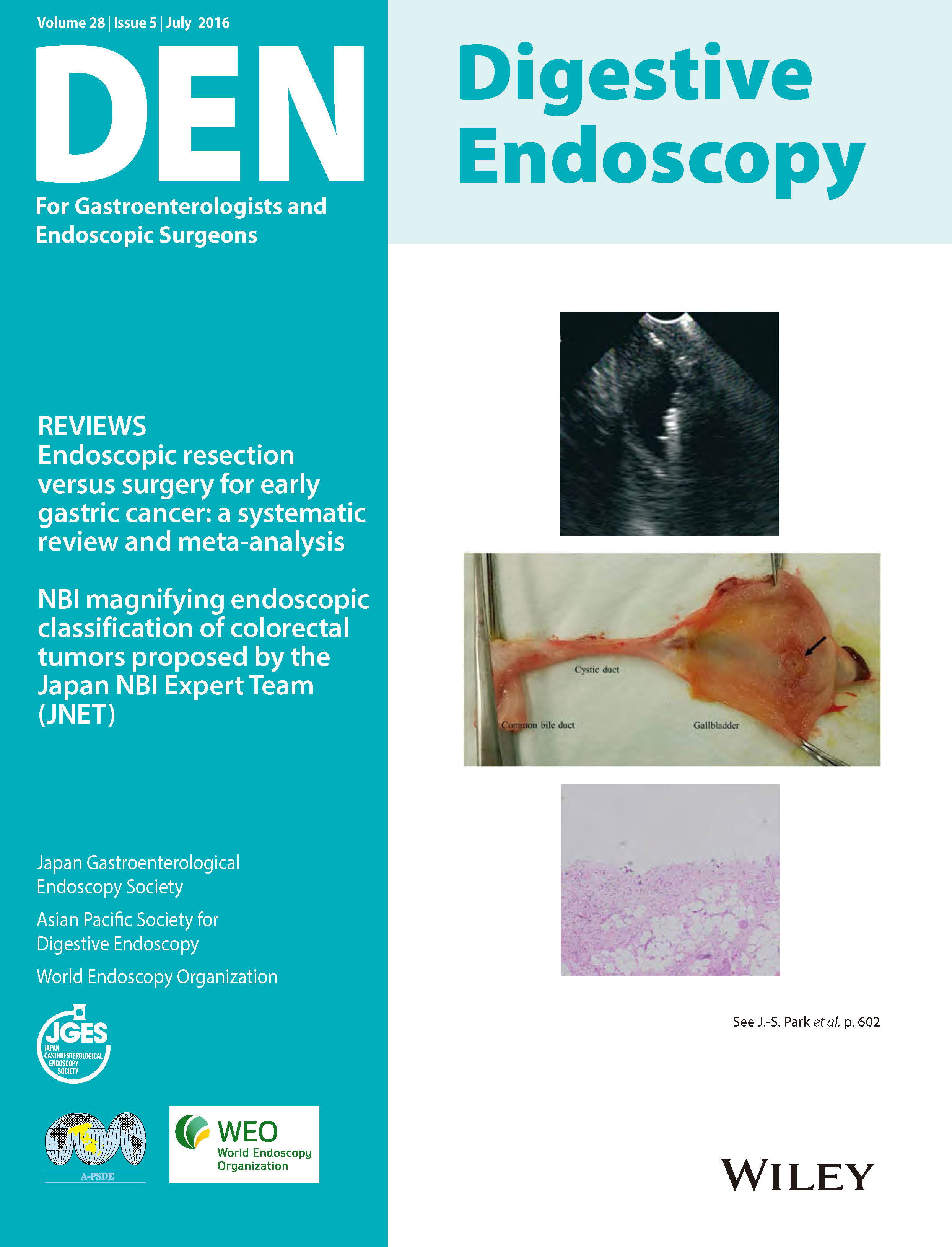 Digestive Endoscopy Vol28-5