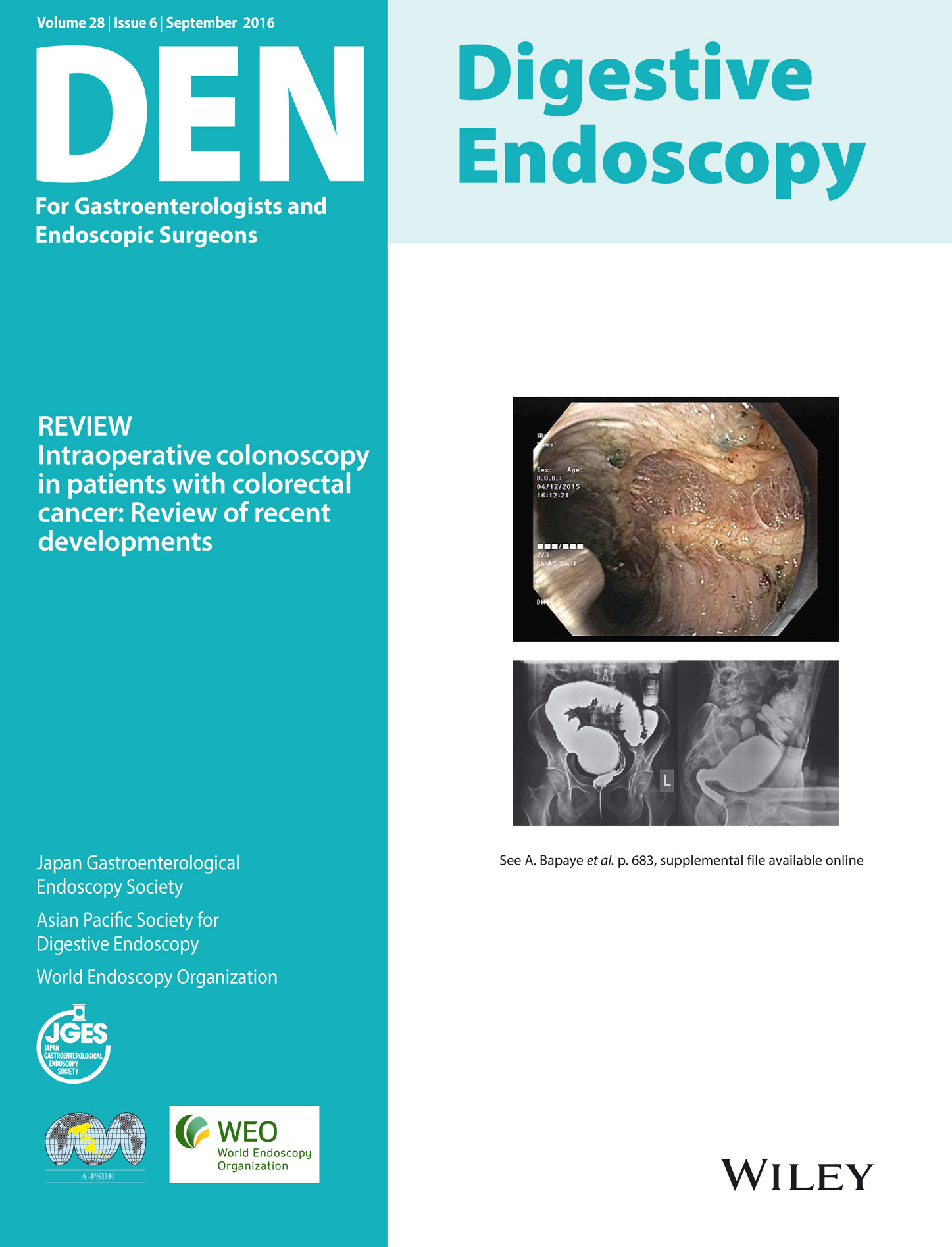 Digestive Endoscopy Vol28-6
