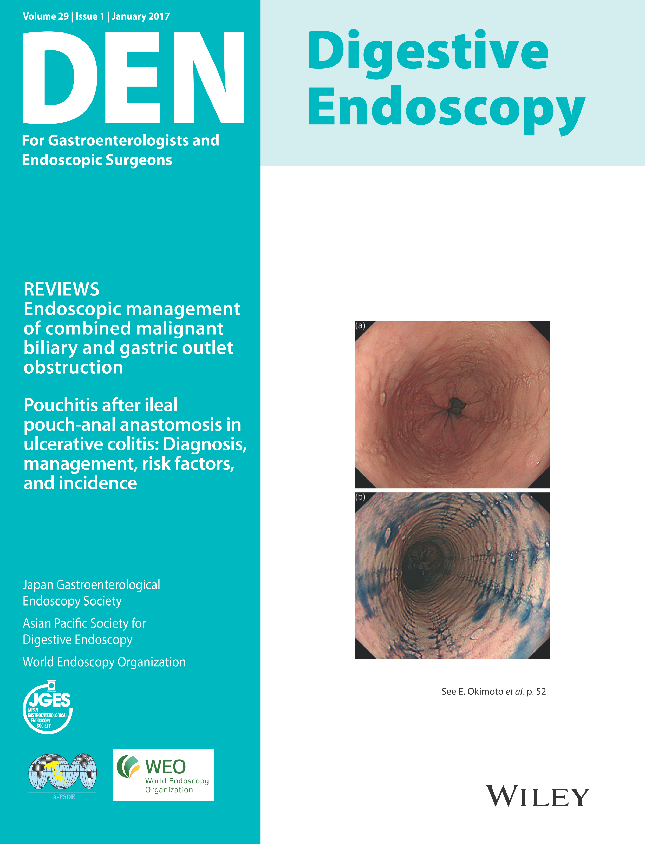 Digestive Endoscopy Vol29-1