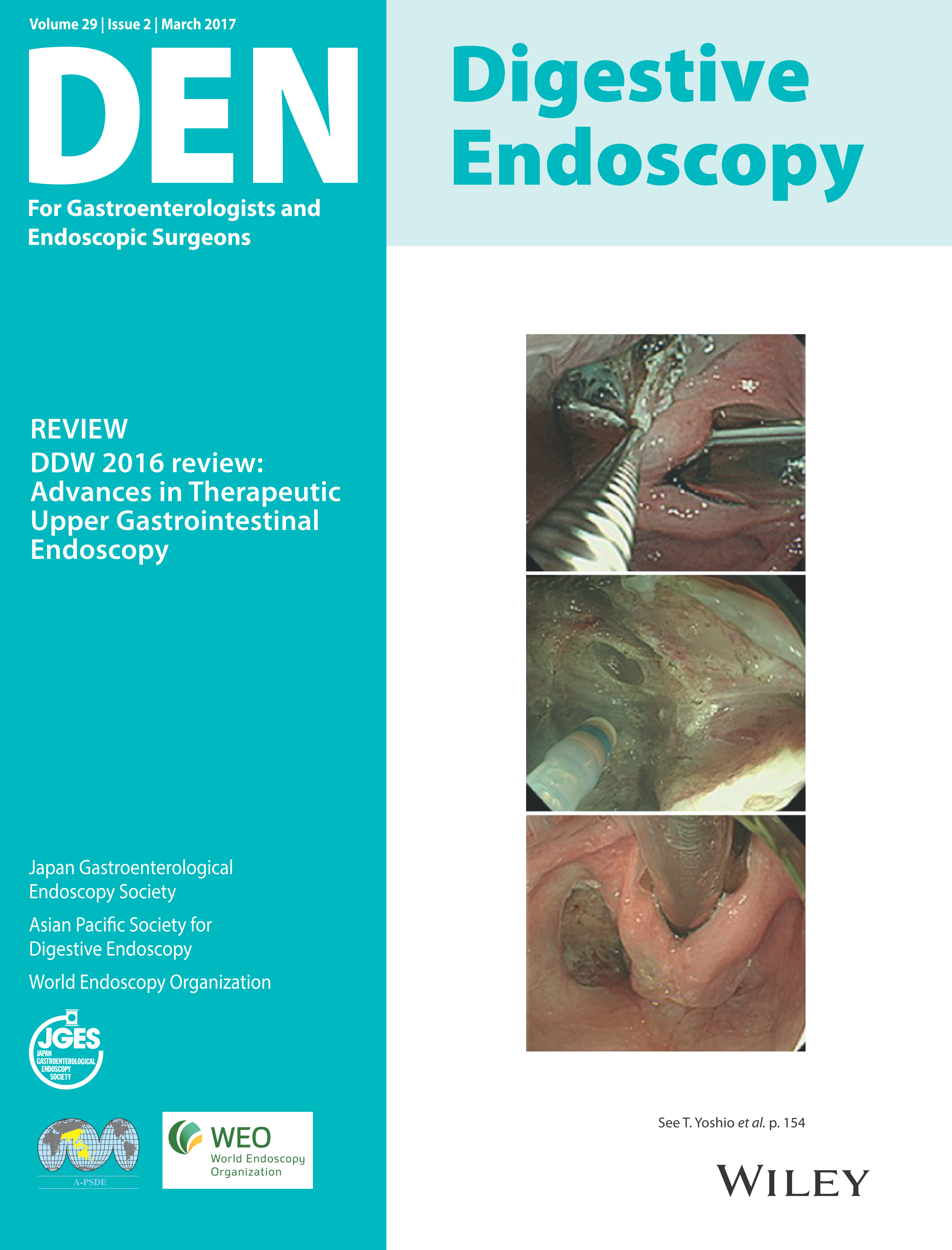 Digestive Endoscopy Vol29-2