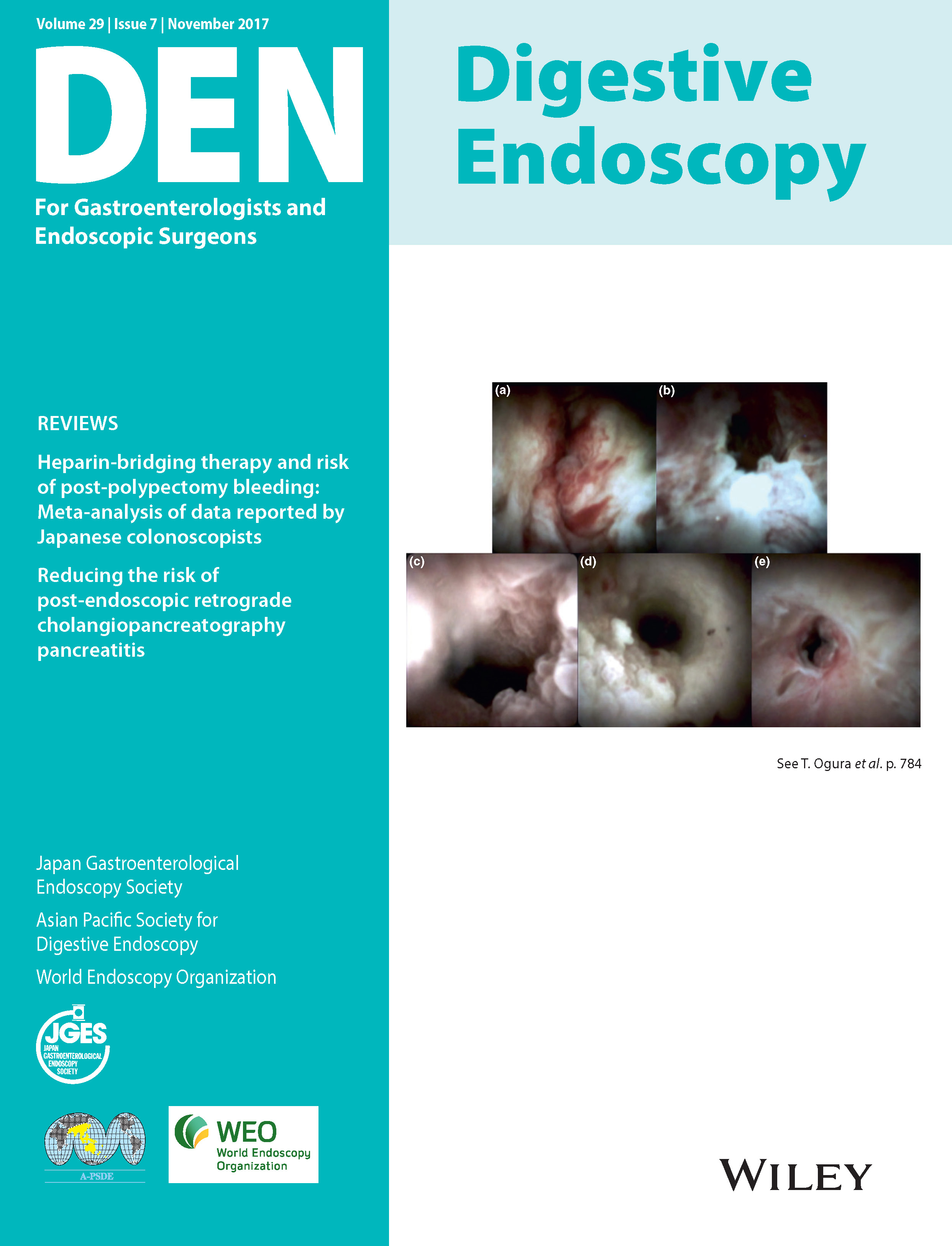 Digestive Endoscopy Vol29-7
