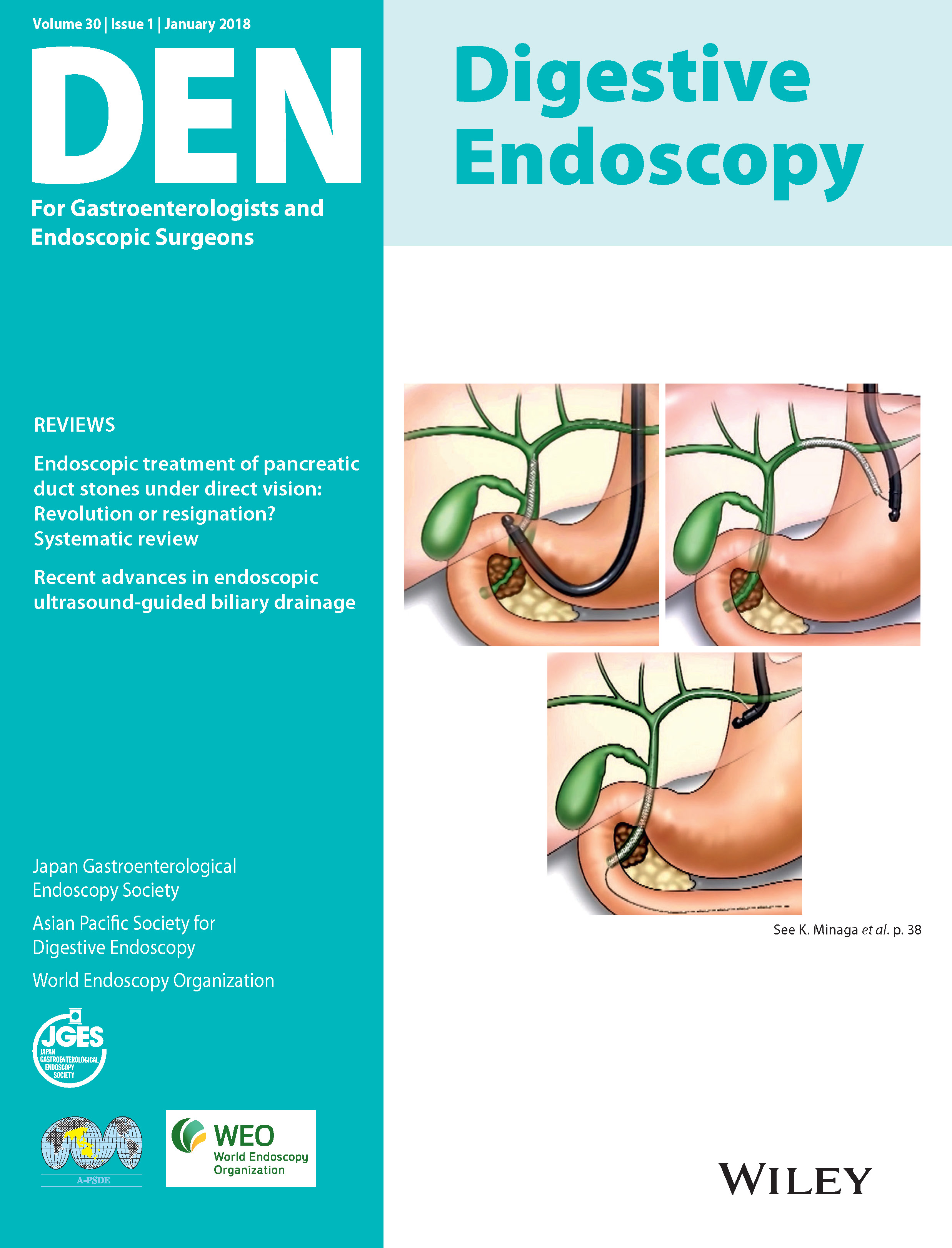 Digestive Endoscopy Vol30-1