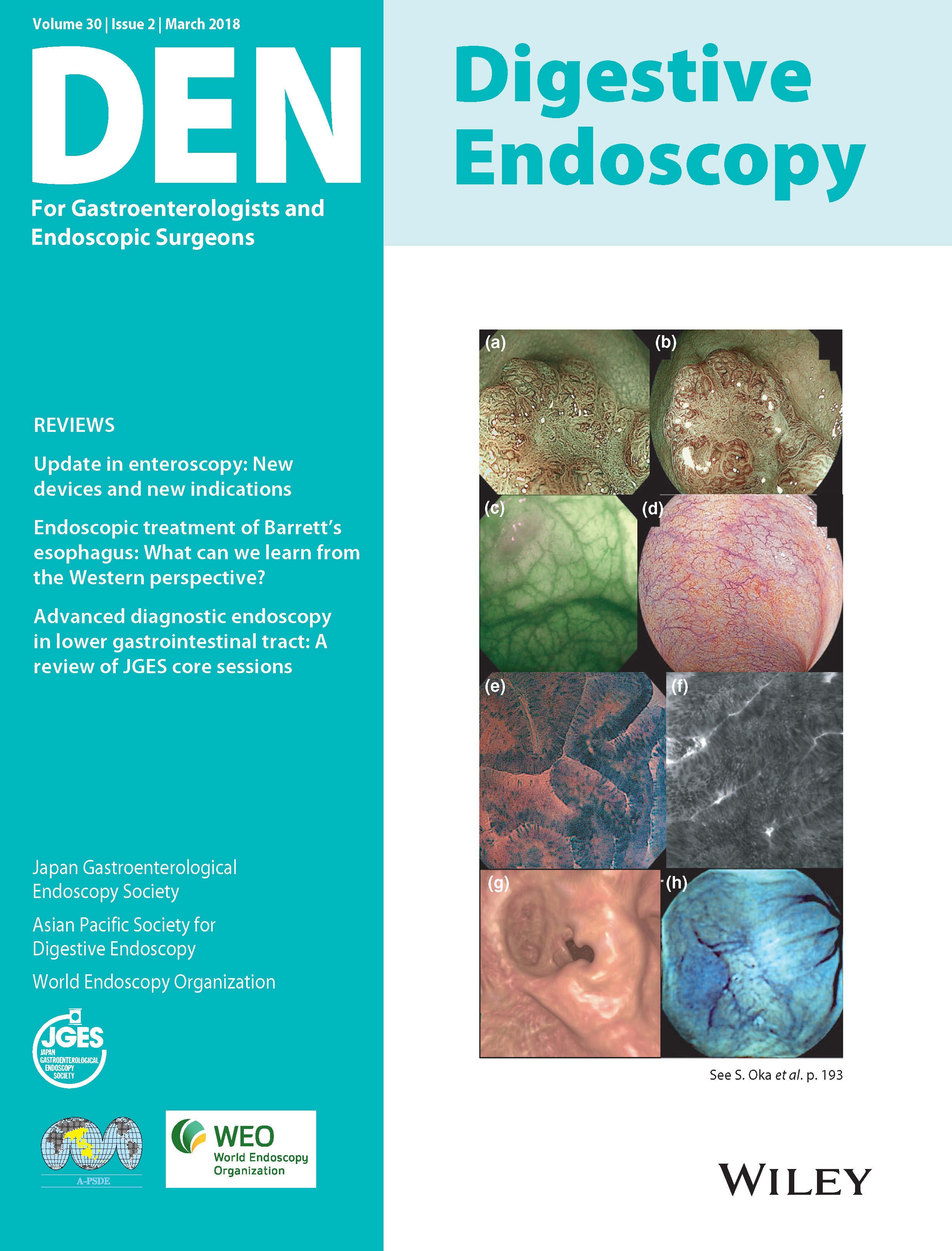 Digestive Endoscopy Vol30-2