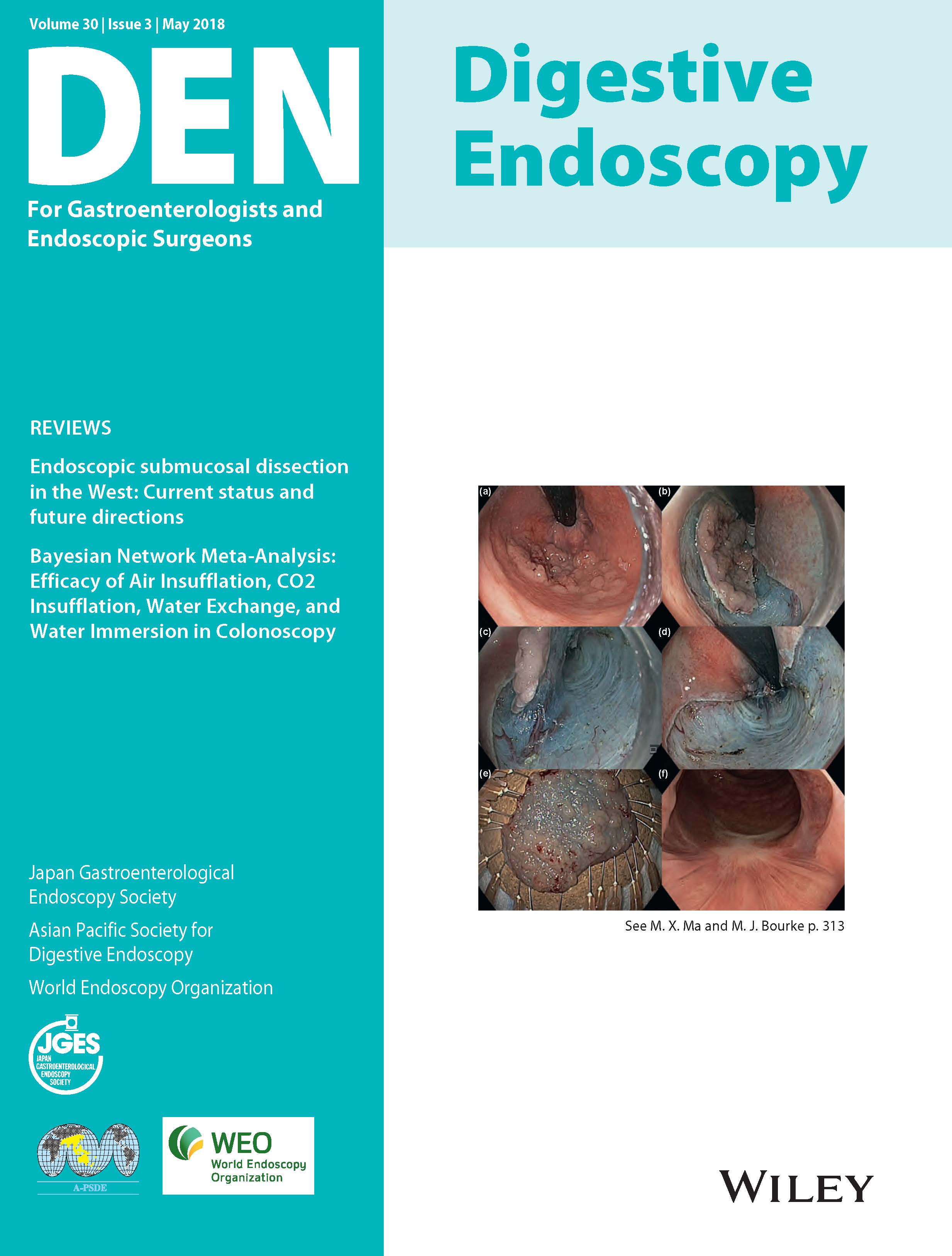 Digestive Endoscopy Vol30-3
