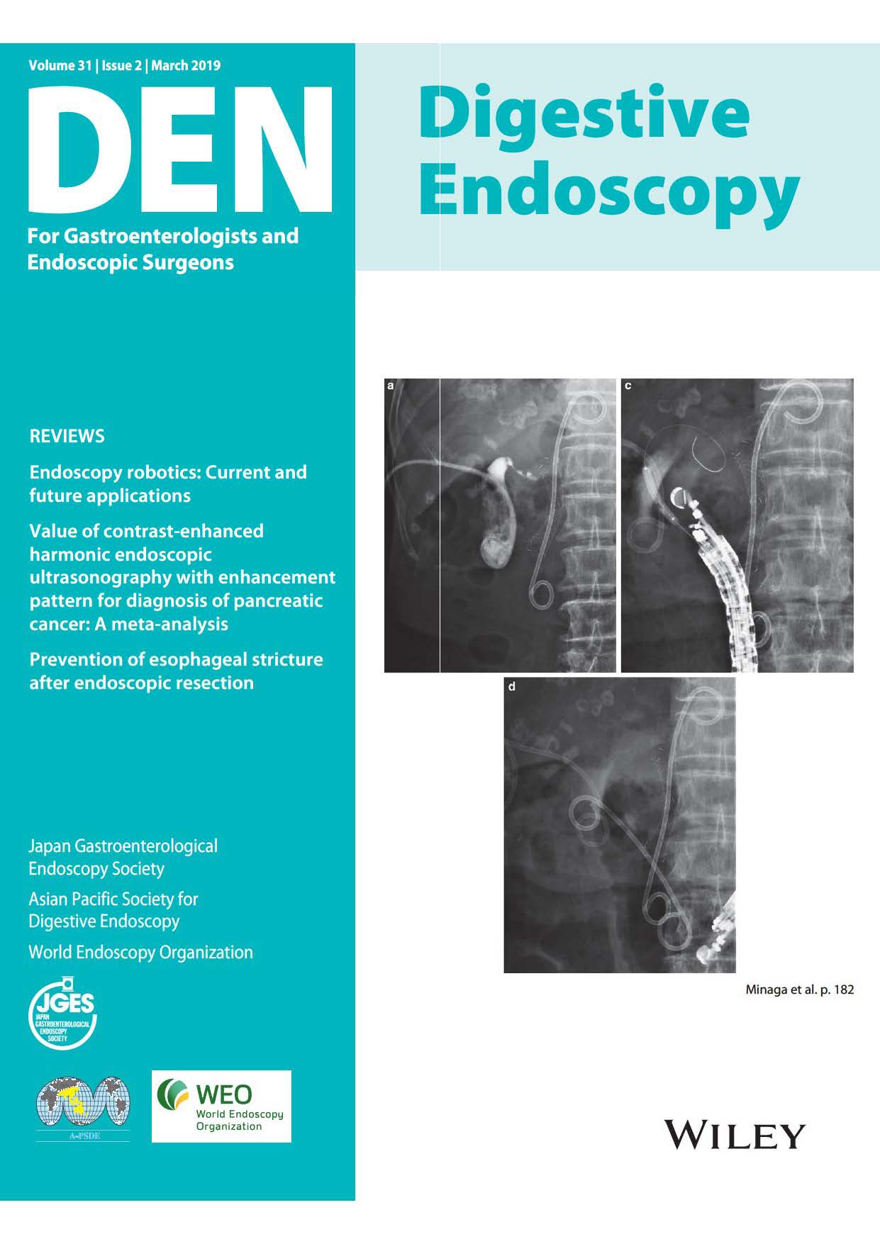 Digestive Endoscopy Vol31-2