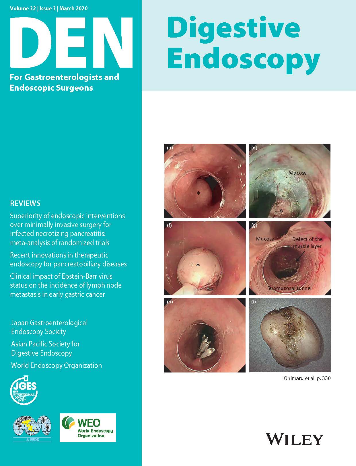 Digestive Endoscopy Vol32-3