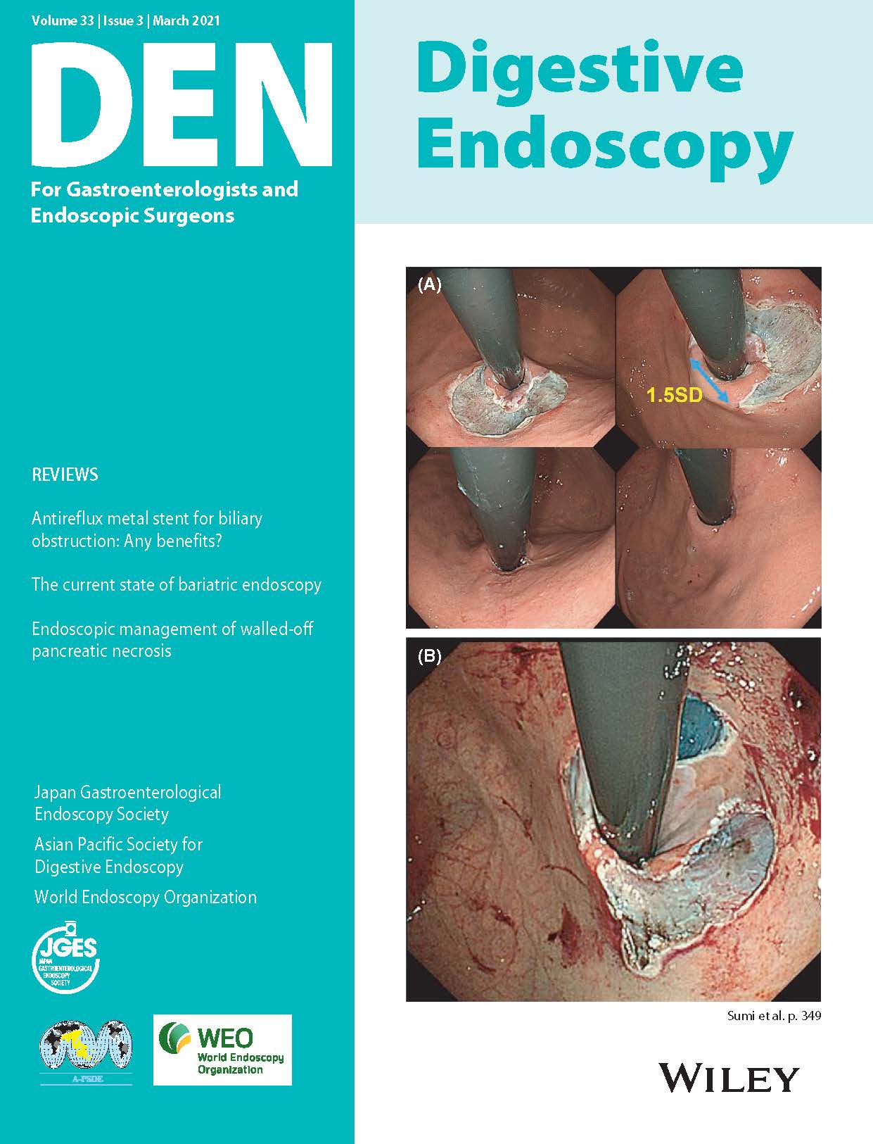 Digestive Endoscopy Vol33-3