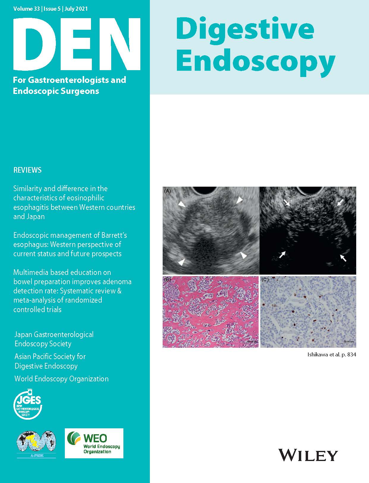 Digestive Endoscopy Vol33-5