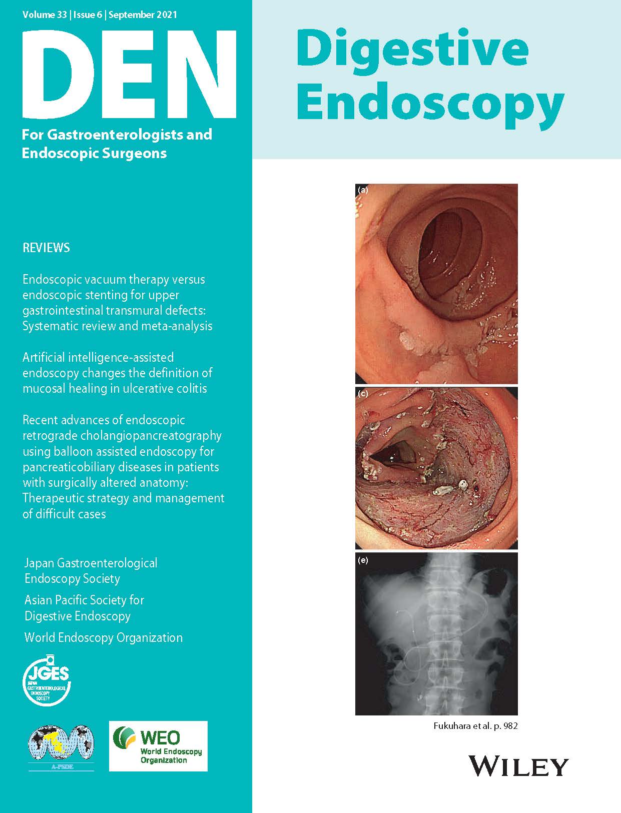 Digestive Endoscopy Vol33-6