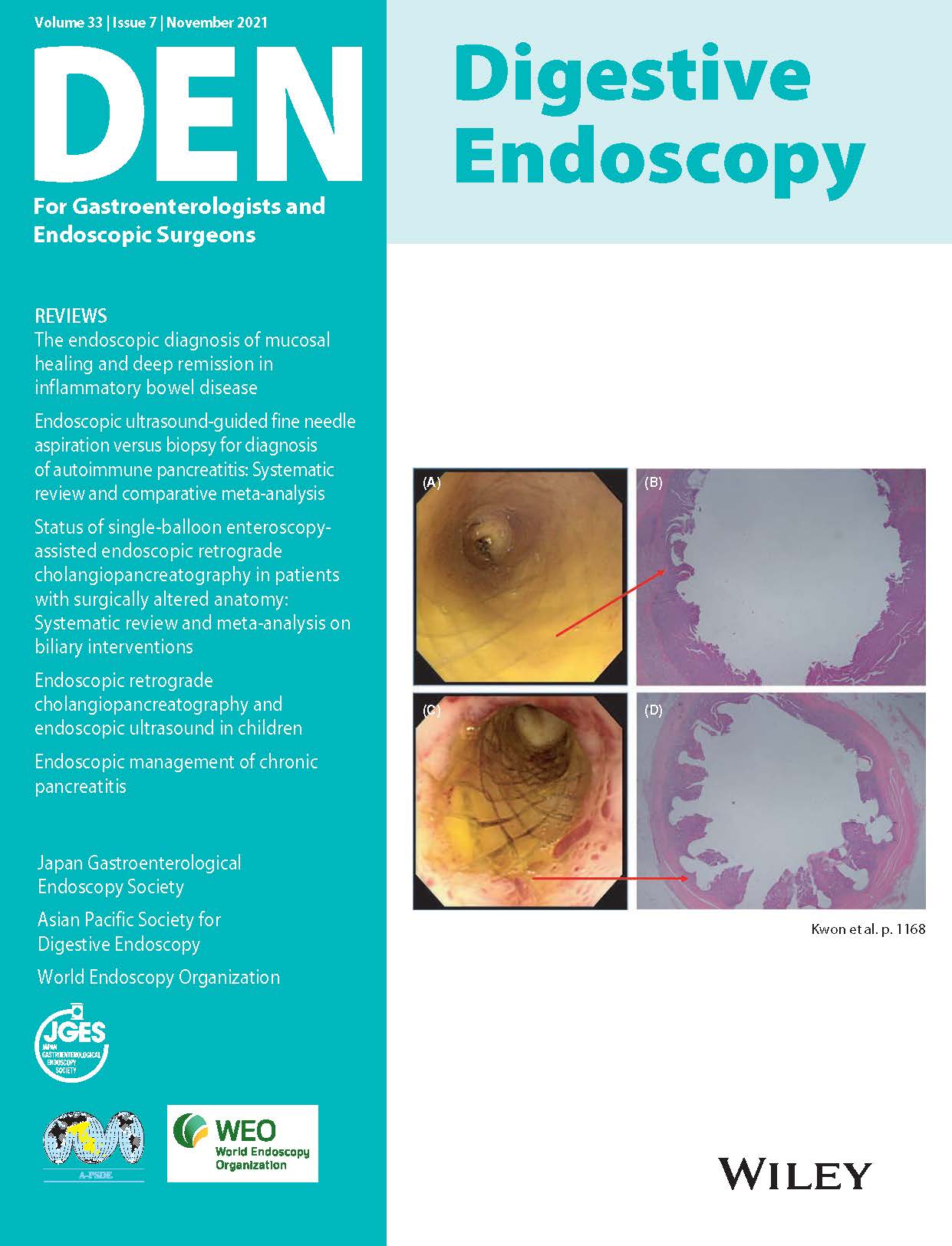 Digestive Endoscopy Vol33-7