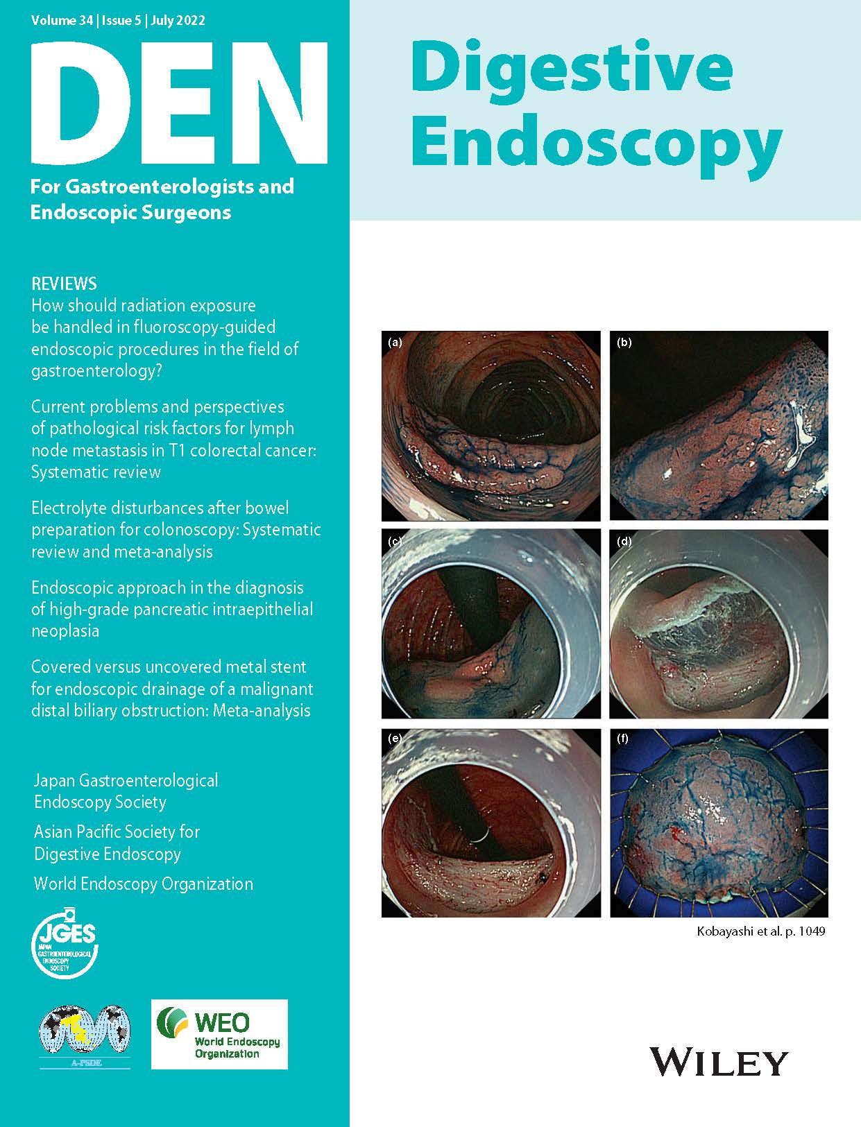 Digestive Endoscopy Vol34-5