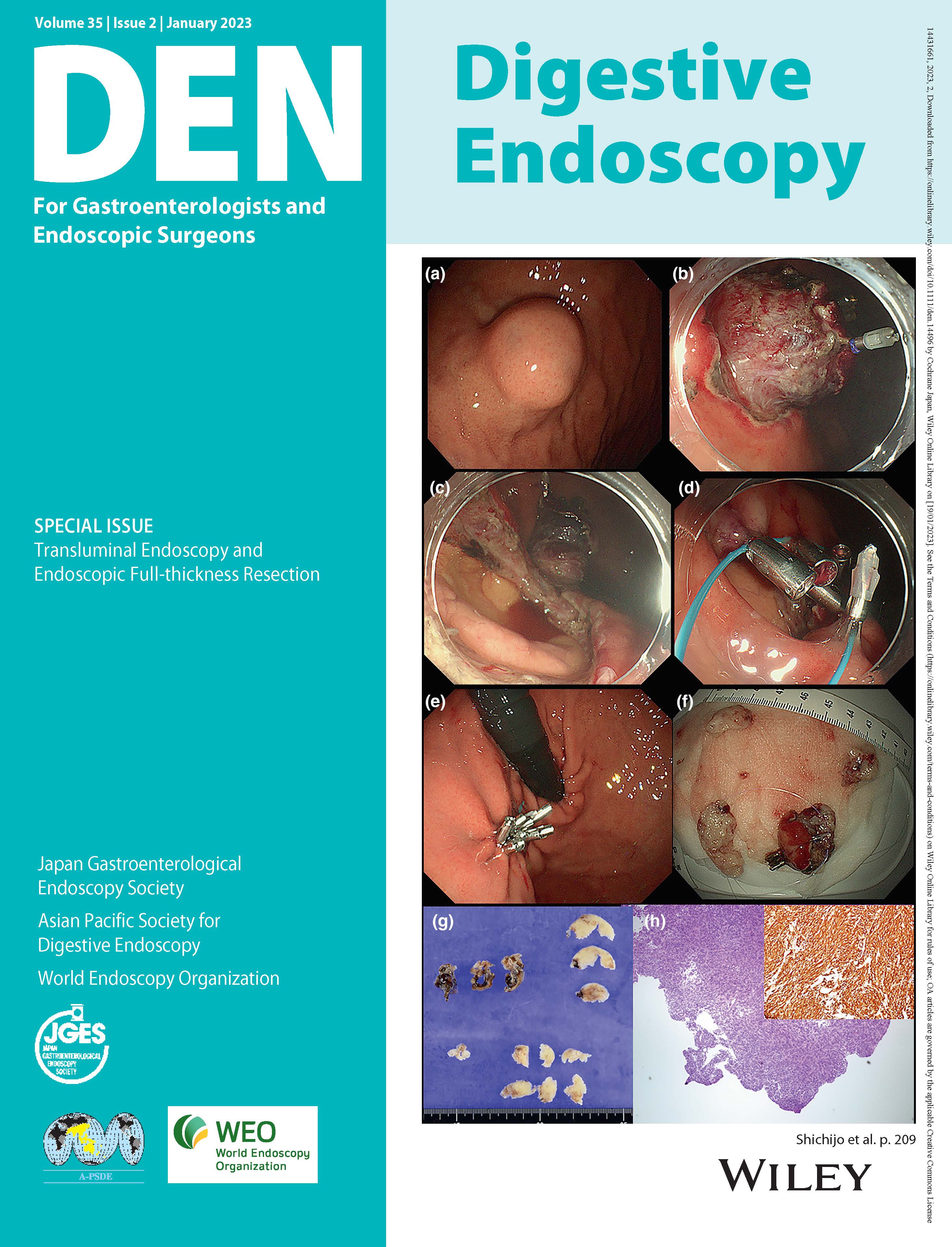 Digestive Endoscopy Vol35-2