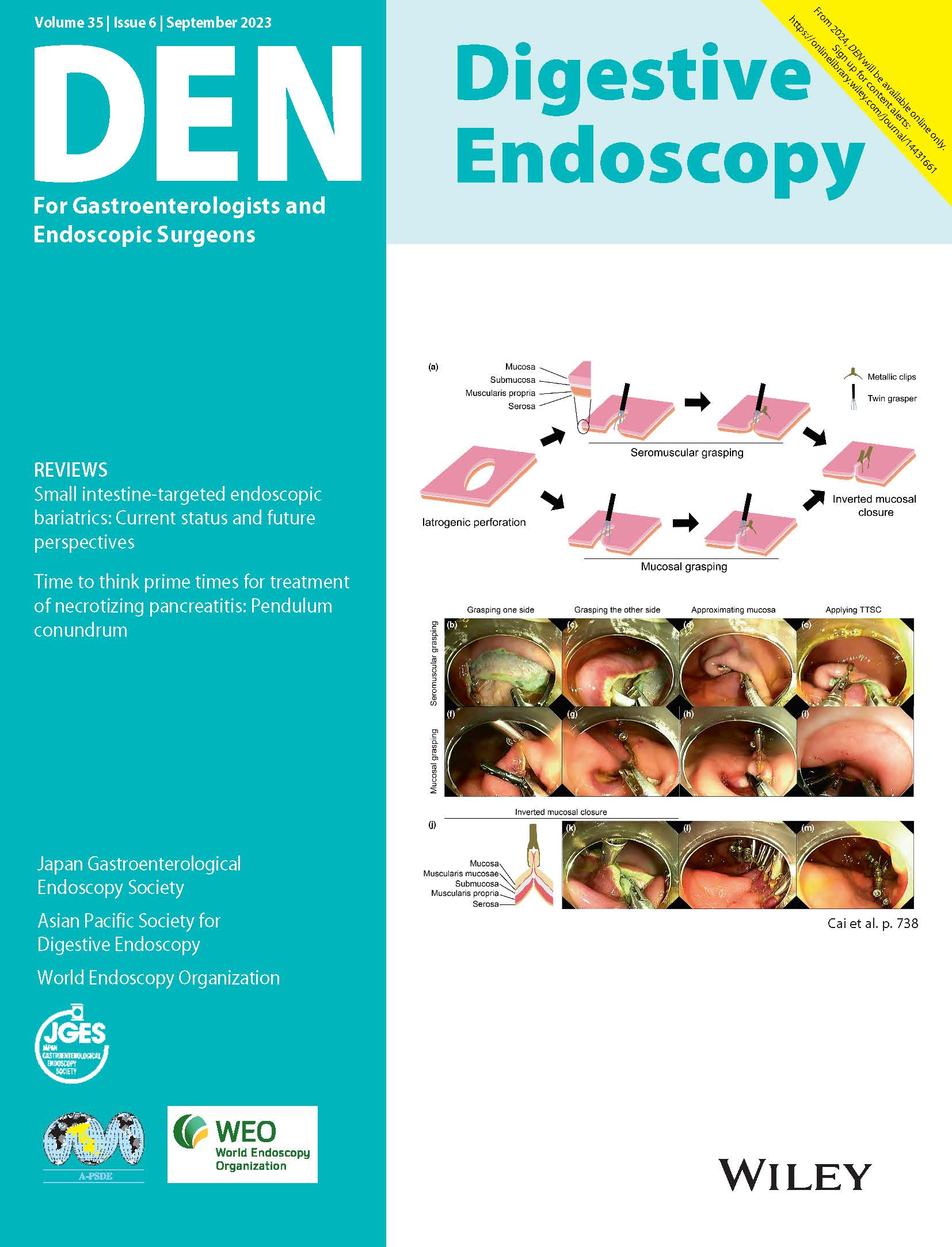 Digestive Endoscopy Vol35-6