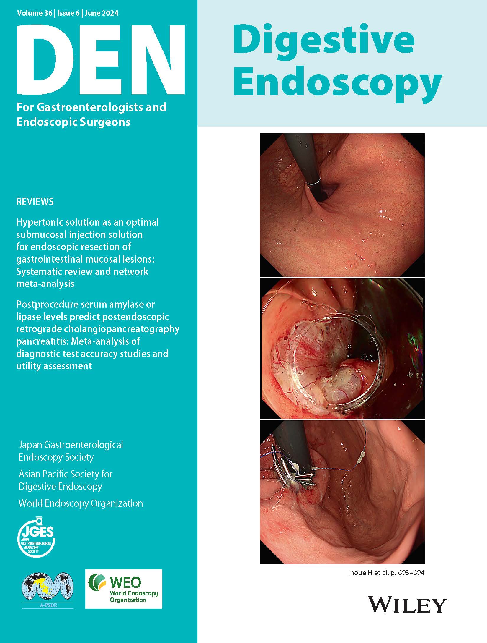 Digestive Endoscopy Vol36-6